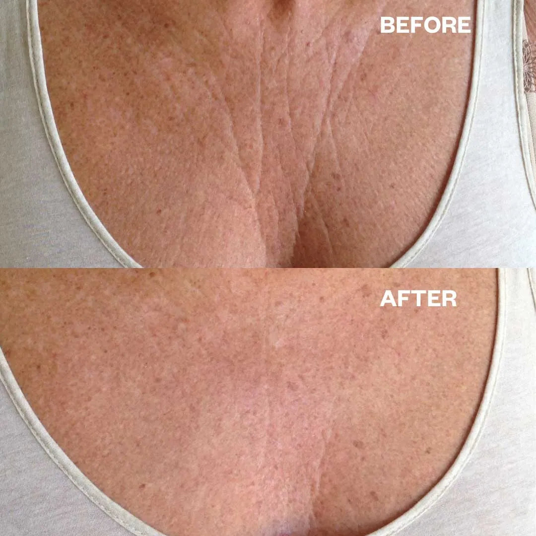 Anti-Wrinkle Chest Pad – Smooth & Firm While You Sleep