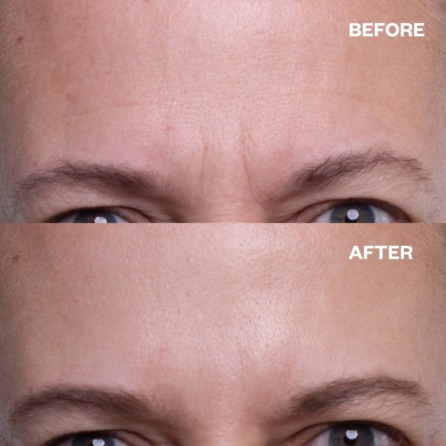 Wake Up to Smoother, Firmer Skin — No Injections, No Hassle