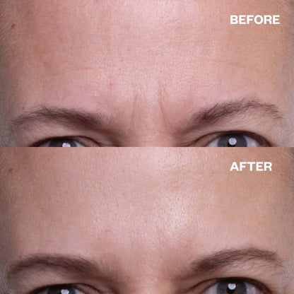 Wake Up to Smoother, Firmer Skin — No Injections, No Hassle