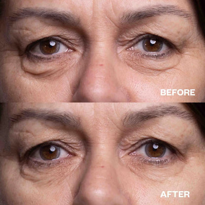 Anti-Wrinkle Eye Pads – Reusable Silicone (Under-Eye Area)